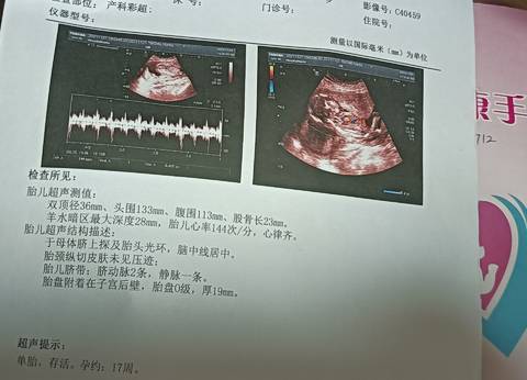 journal_insert_pic_1683385469