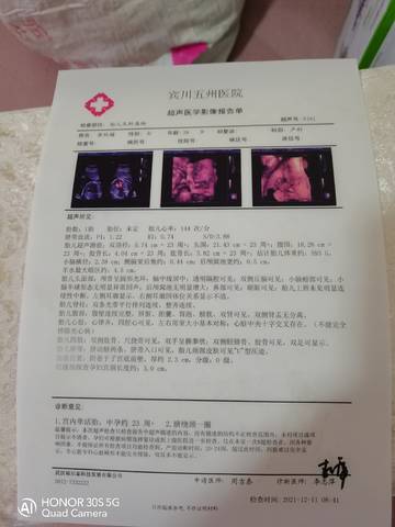 journal_insert_pic_1678592566