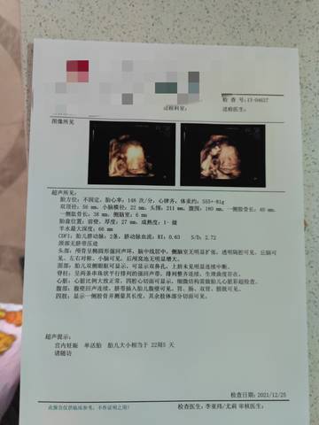 journal_insert_pic_1687364562