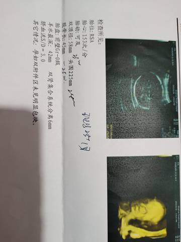 journal_insert_pic_1681358095