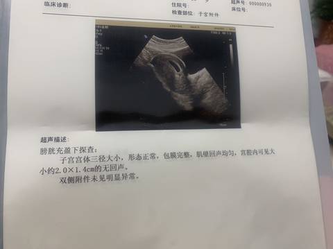 journal_insert_pic_1673073799