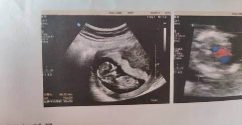 journal_insert_pic_1719600411