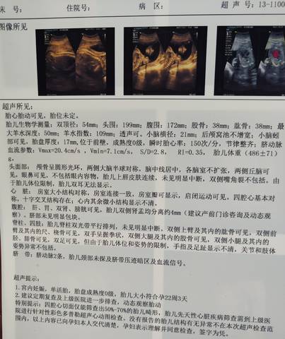 journal_insert_pic_1688072892