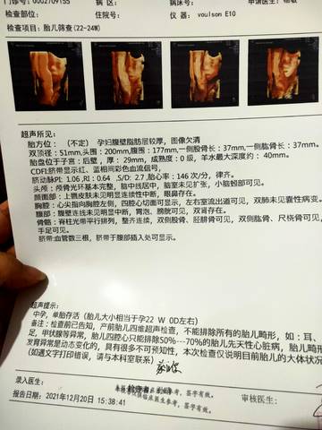 journal_insert_pic_1683306688