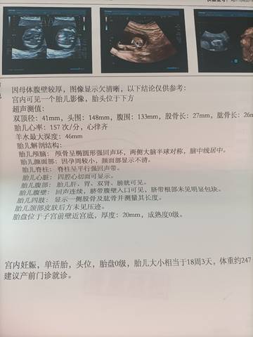 journal_insert_pic_1680135941