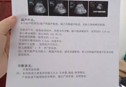 journal_insert_pic_1674054883