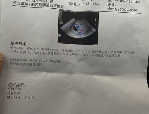 journal_insert_pic_1685902407