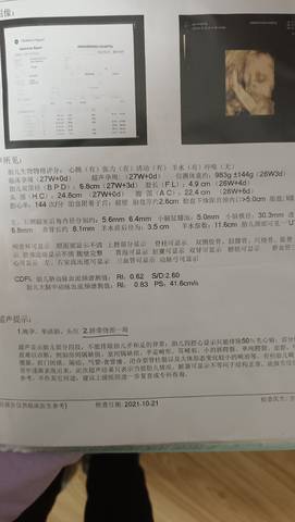 journal_insert_pic_1677373231