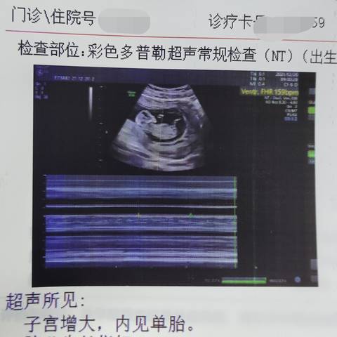 journal_insert_pic_1689723207