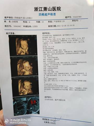 journal_insert_pic_1688404804