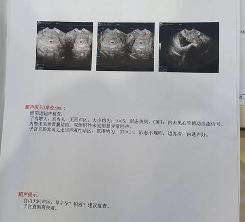journal_insert_pic_1682939999
