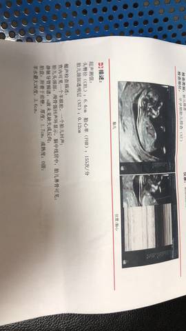 journal_insert_pic_1677380801