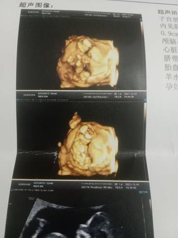 journal_insert_pic_1677790031