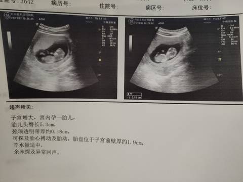 journal_insert_pic_1675520156