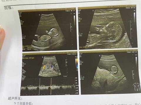 journal_insert_pic_1680987958