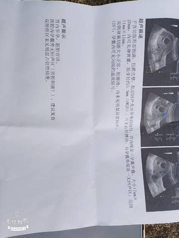journal_insert_pic_1690046693