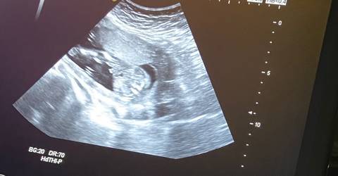 journal_insert_pic_1689722163