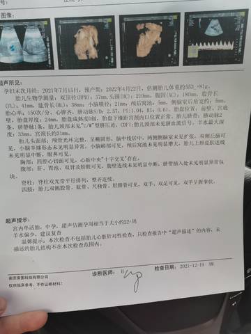 journal_insert_pic_1682462129