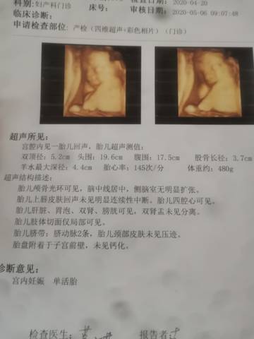 journal_insert_pic_1686052419