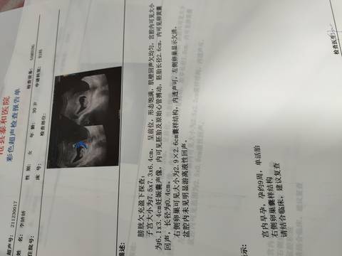 journal_insert_pic_1688985405