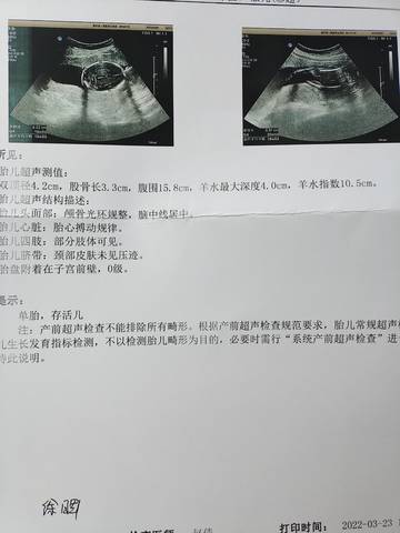 journal_insert_pic_1741053834