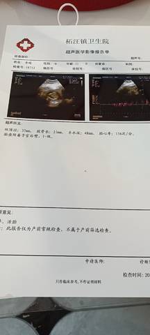 journal_insert_pic_1673510054