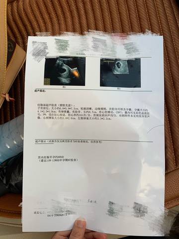journal_insert_pic_1688354817