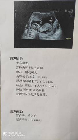 journal_insert_pic_1690232017