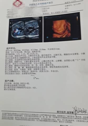 journal_insert_pic_1688409225