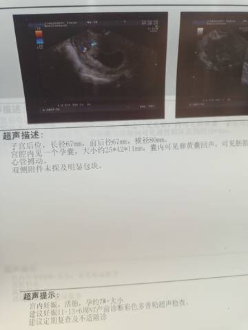 journal_insert_pic_1675981683