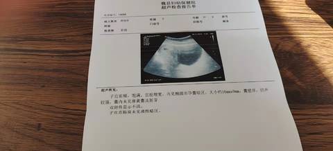 journal_insert_pic_1690306378