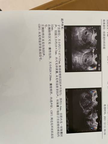 journal_insert_pic_1677935561