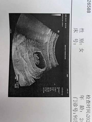 journal_insert_pic_1685007031