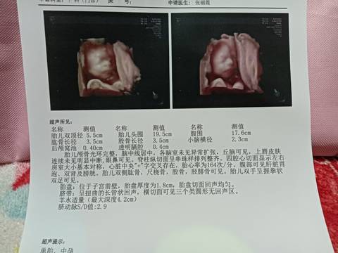 journal_insert_pic_1681084828
