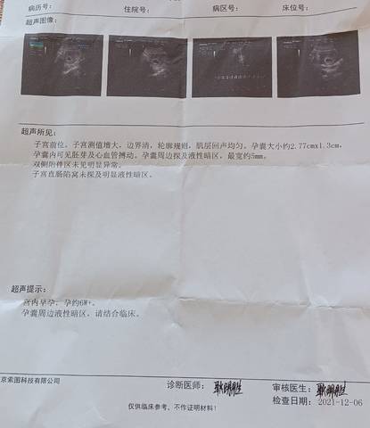 journal_insert_pic_1678131974