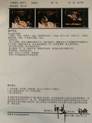 journal_insert_pic_1688221534