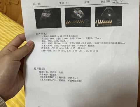journal_insert_pic_1684903551