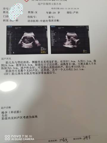 journal_insert_pic_1675652520