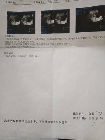 journal_insert_pic_1683885797