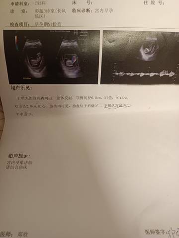 journal_insert_pic_1674435147