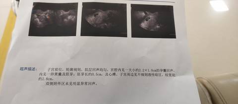 journal_insert_pic_1689548603