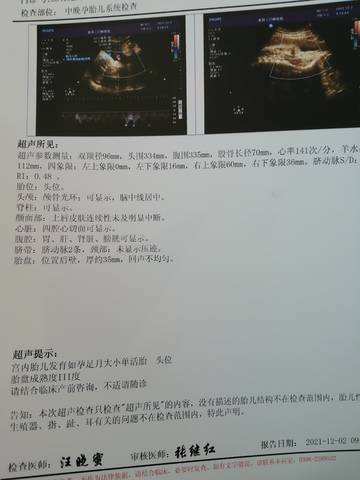 journal_insert_pic_1674336172