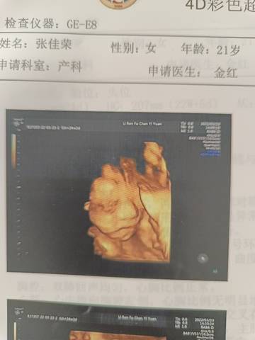 journal_insert_pic_1741005752