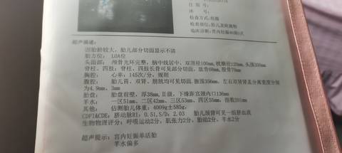 journal_insert_pic_1677082435