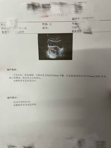 journal_insert_pic_1674012990