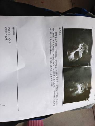 journal_insert_pic_1686430240