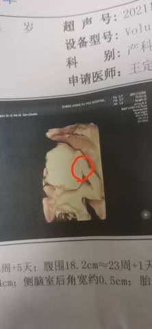 journal_insert_pic_1677188520