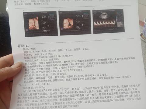 journal_insert_pic_1719455908