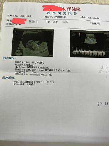 journal_insert_pic_1683754322