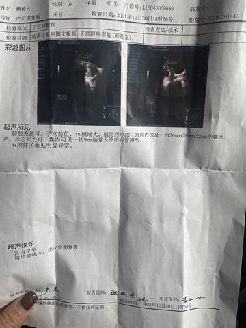 journal_insert_pic_1689178338